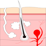 Hair Follicle 2