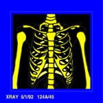 X-ray