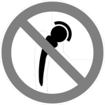 No Metal Implants